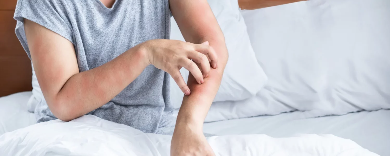 Valérie Boullenger et la méthode BBA pour lutter contre les allergies aux acariens.