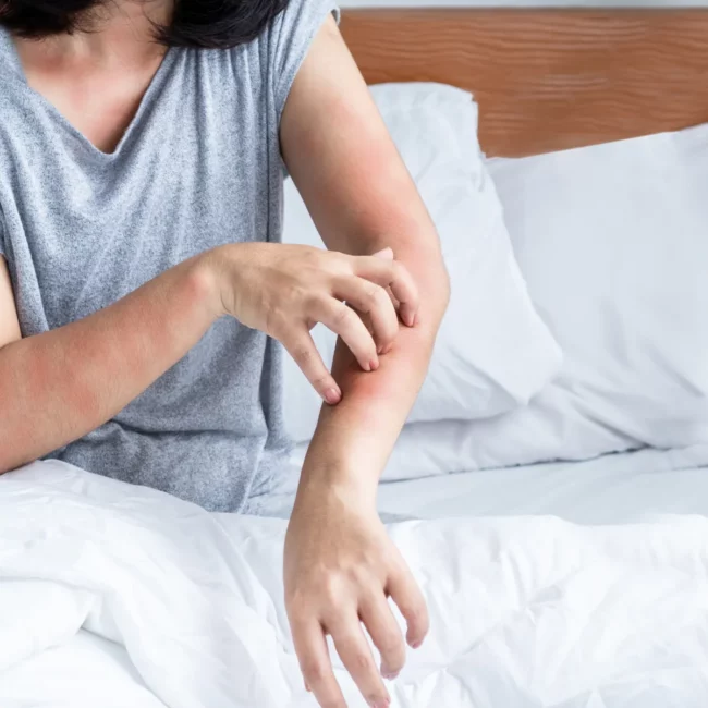 Valérie Boullenger et la méthode BBA pour lutter contre les allergies aux acariens.