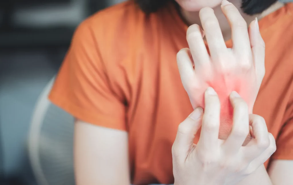 Une femme se gratte en réaction à son allergie aux piqûres d’insectes.