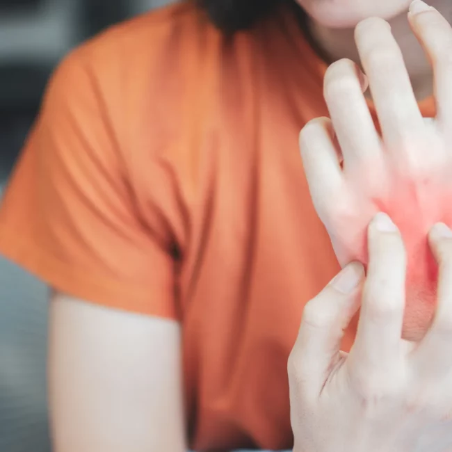 Une femme se gratte en réaction à son allergie aux piqûres d’insectes.